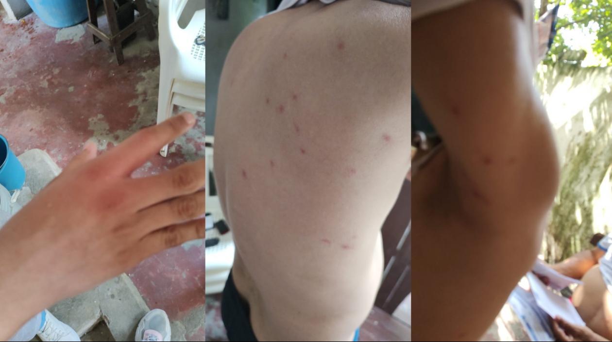 Estudiantes atacados por abejas africanizadas en Barranquilla