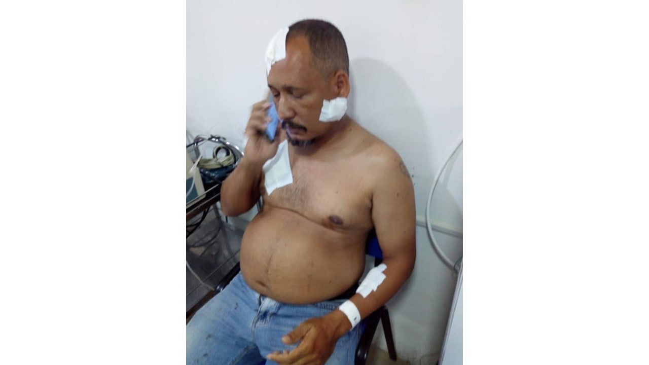 José Ángel Polo. Taxista herido