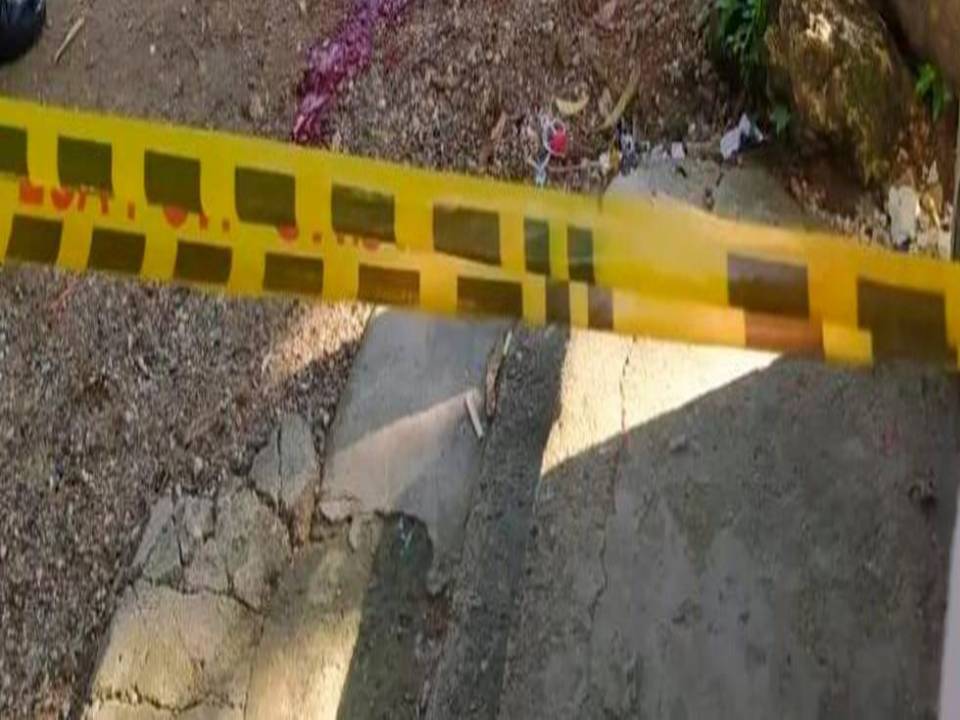 La víctima fue atacada cuando se encontraba sentado en una banca