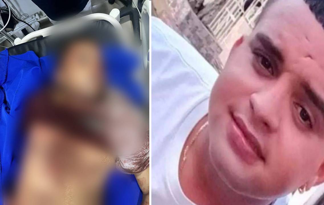 Le dispararon a quema ropa y sin mediar palabra