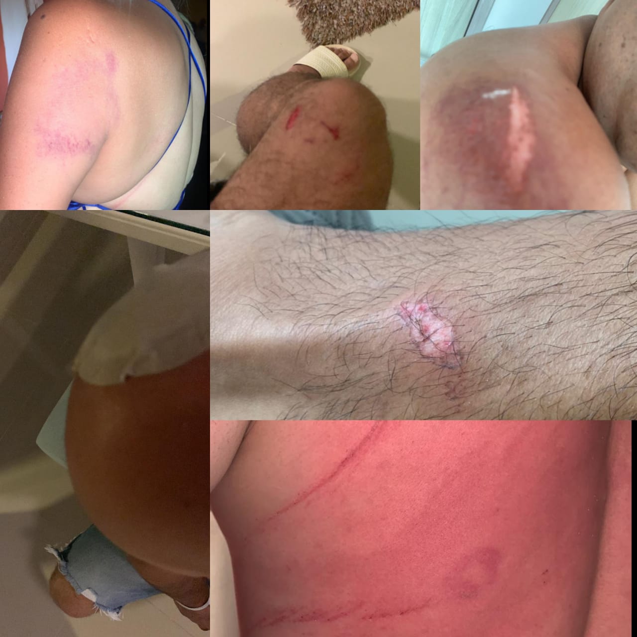 Turistas heridos en isla de Cartagena