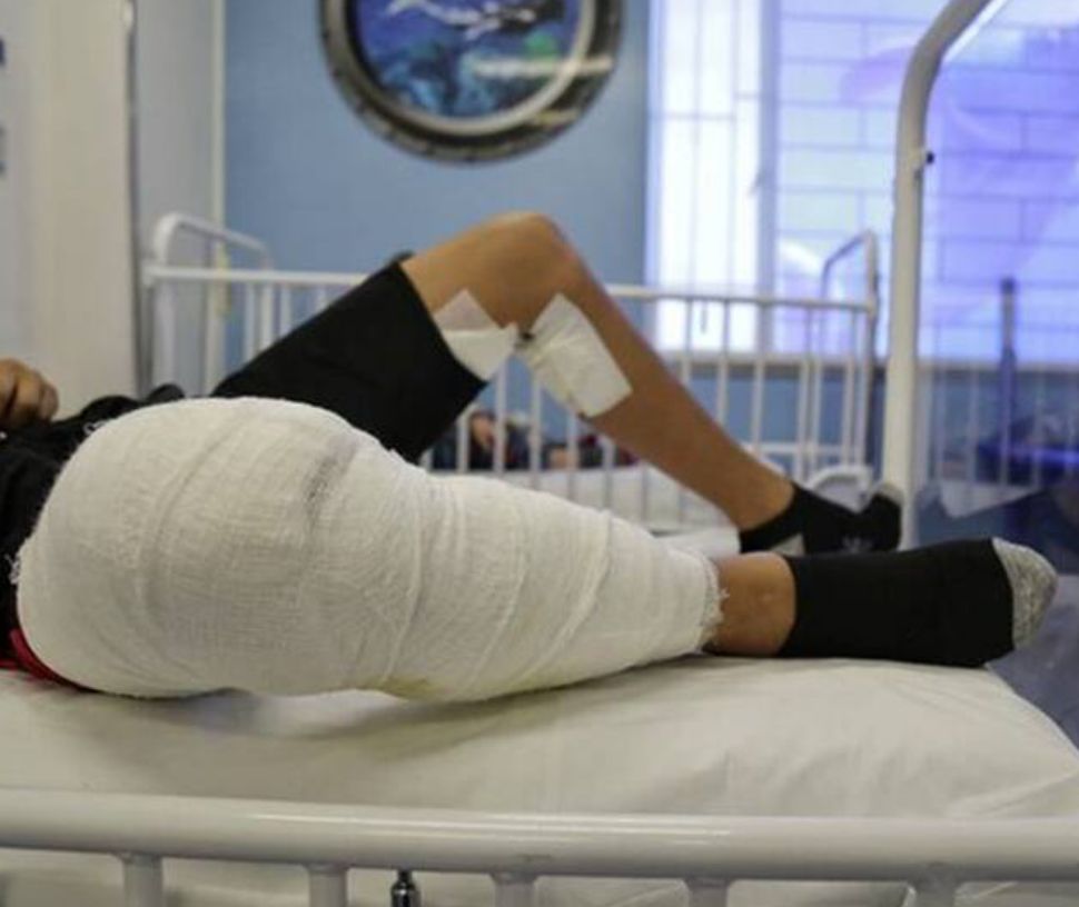 Falleció turista bogotano luego de sufrir quemaduras por incendio en Santa Marta