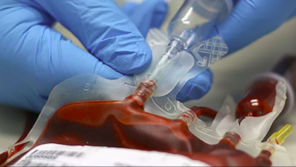 imagen de referencia