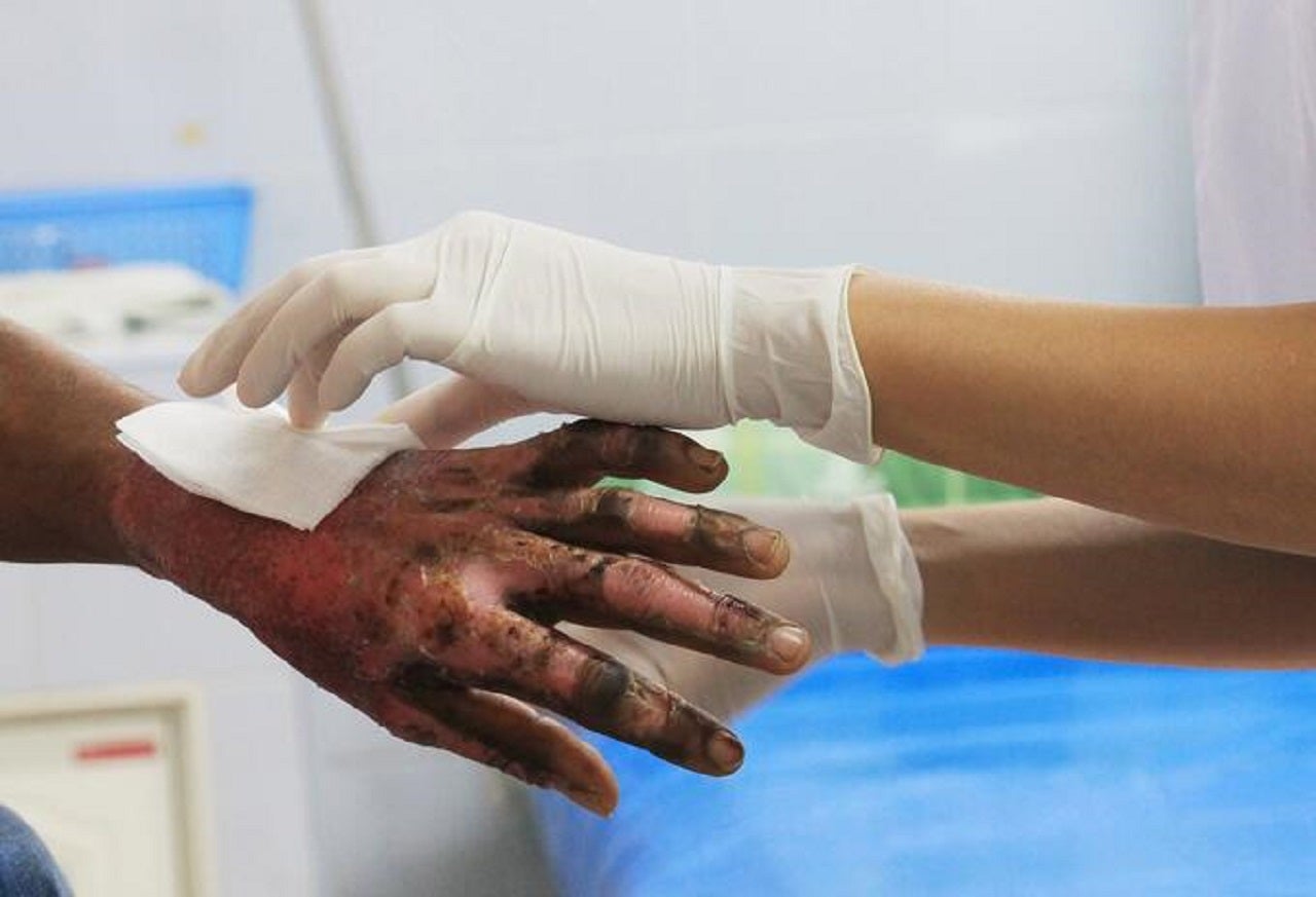 Niño de 6 años muere al ingerir polvora en Santander