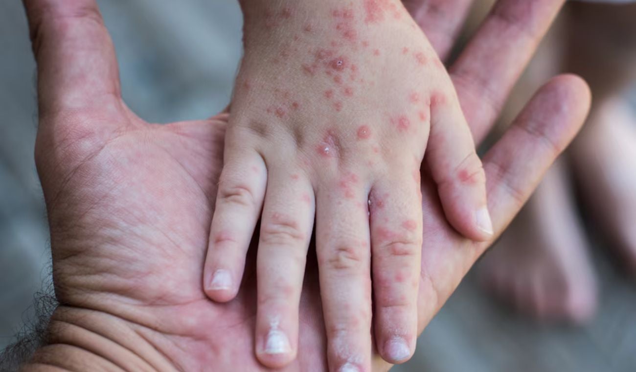 Fotografía no relacionada directamente con los hechos