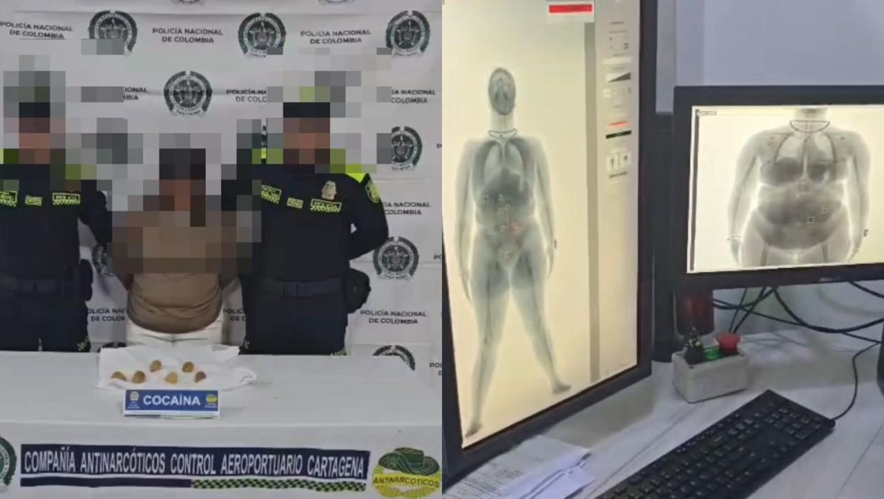 Capturan a mujer en el aeropuerto de Cartagena con cocaína oculta en su estómago