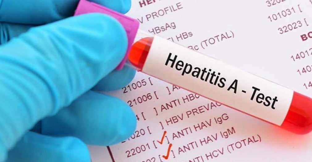 Hepatitis