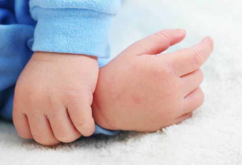 Imagen de Referencia.