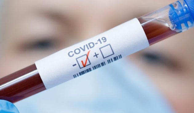 El Tolima reportó 468 nuevos casos de coronavirus