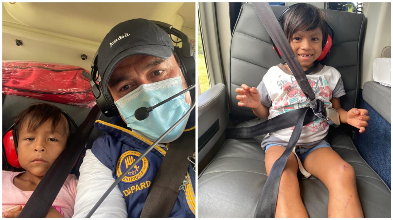 Las niñas presentan signos de desnutrición.