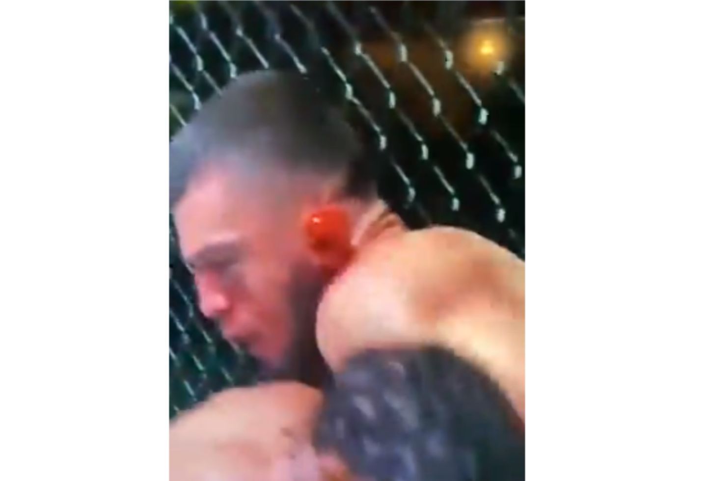Peleador de UFC casi pierde una oreja
