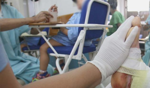 Van 66 personas lesionadas con pólvora este año en Antioquia