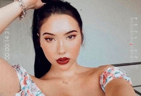 Aida Victoria reveló peculiar detalle en sus pies: “La pata se veía negra”