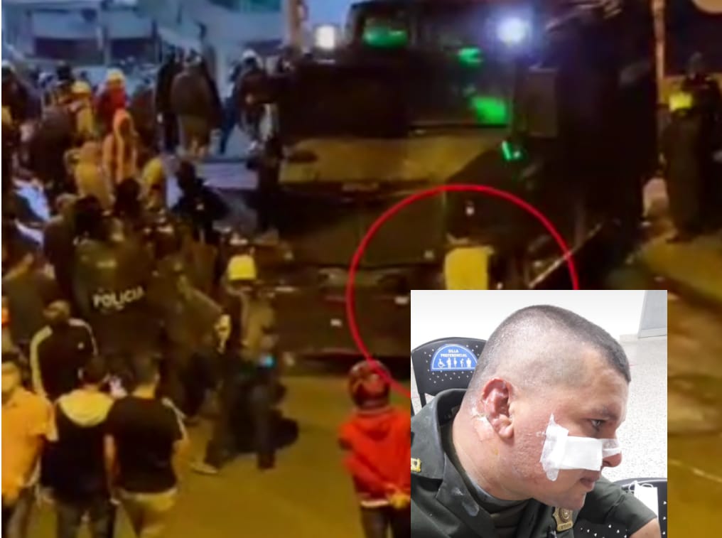 Una bomba molotov le quemó el rostro a un policía en Caldas, Antioquia