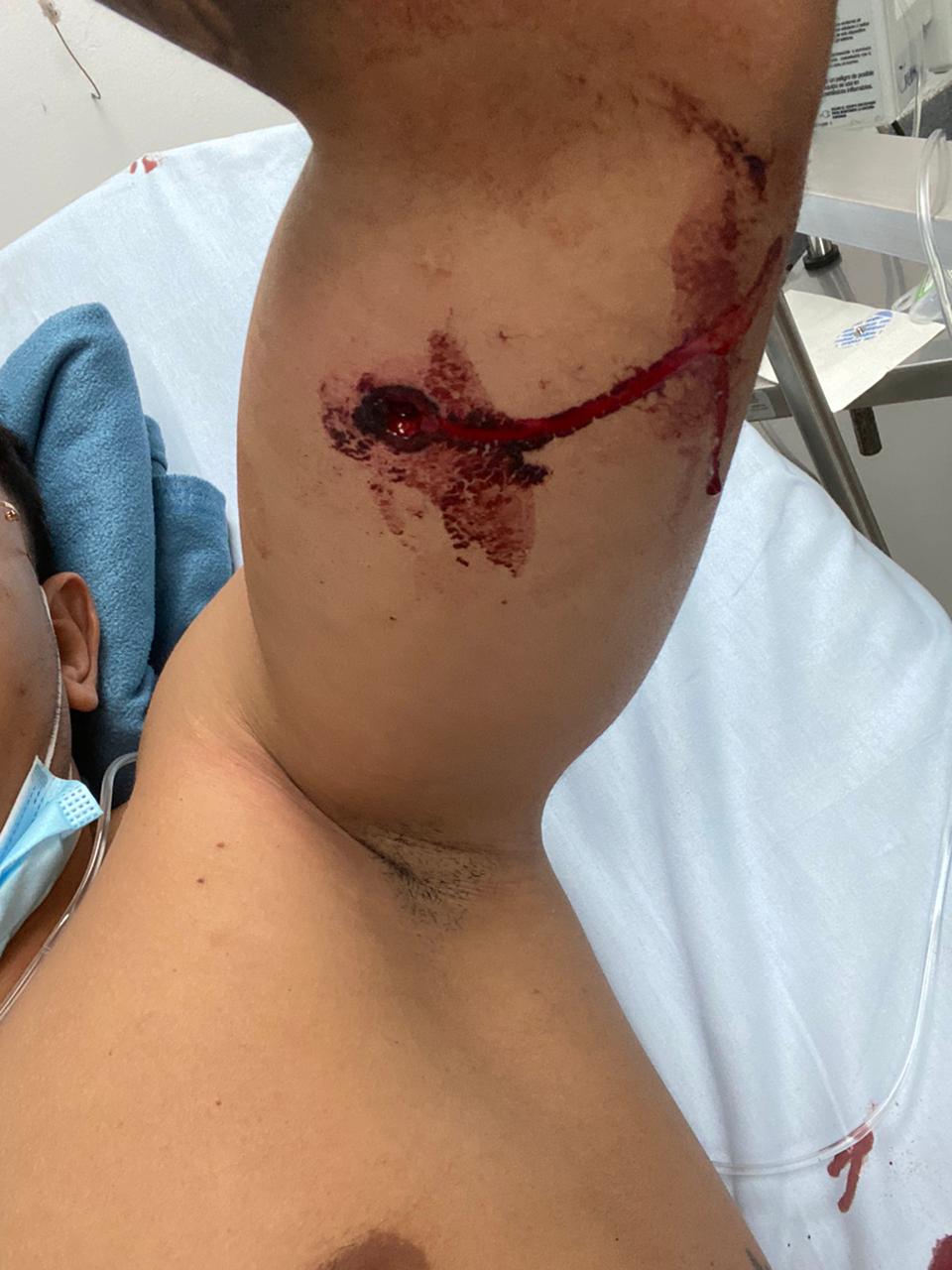 Joven sobrevivió a tres disparos en un intento de hurto en Bello, Antioquia