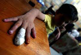 Un niño de cinco años está entre los lesionados recientes.