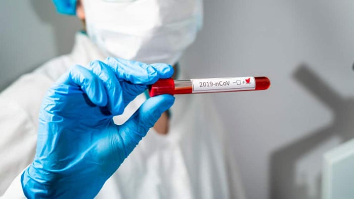 Repunte del coronavirus