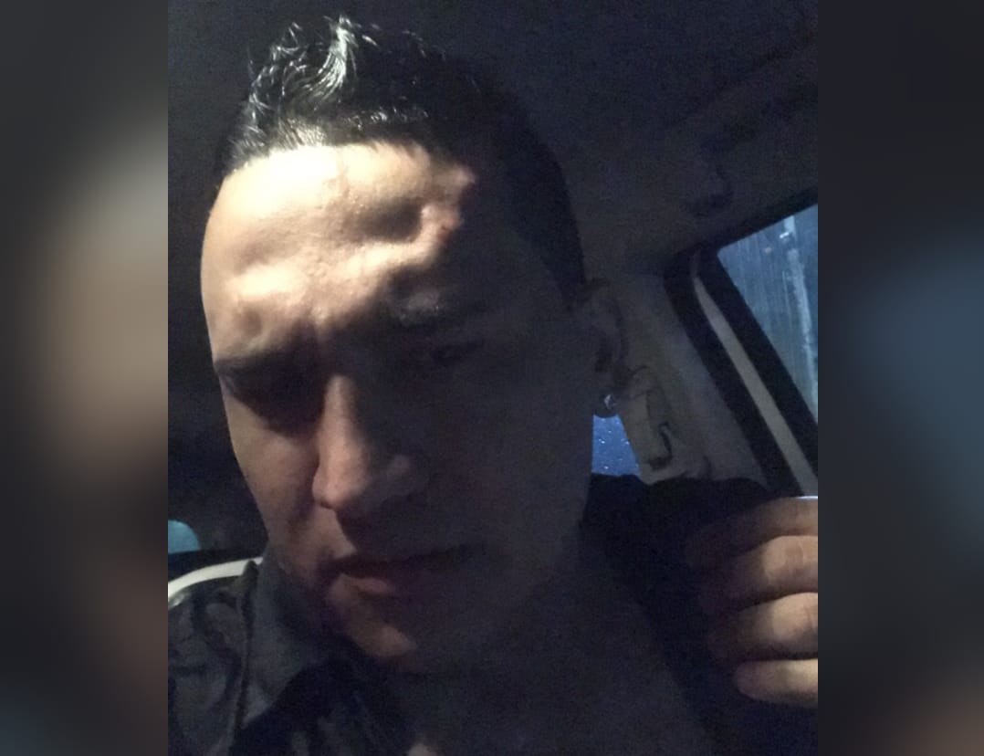 Moretones y Golpes de Felipe Daza