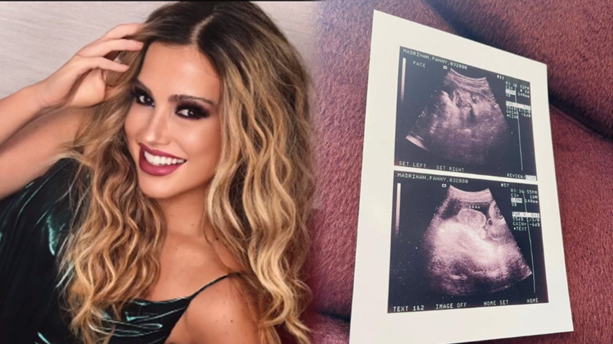 Fanny Lu sorprende a sus seguidores con una ecografía ¿Será mamá por tercera vez?