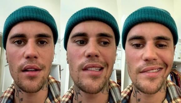 Justin Bieber tiene parálisis facial por síndrome de Ramsay Hunt
