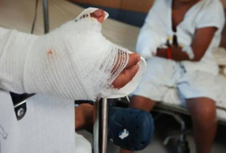 Referencia de personas quemadas