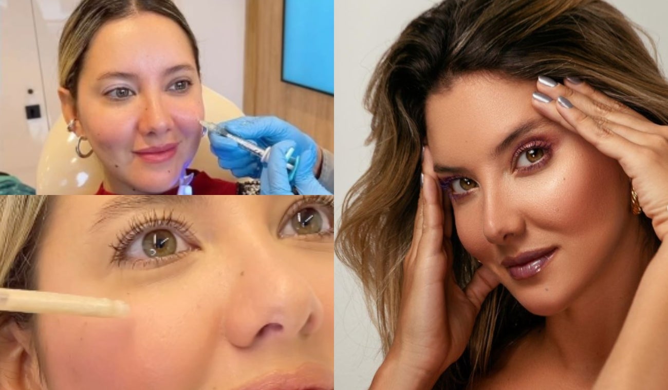 Daniella Álvarez se quemó la cara