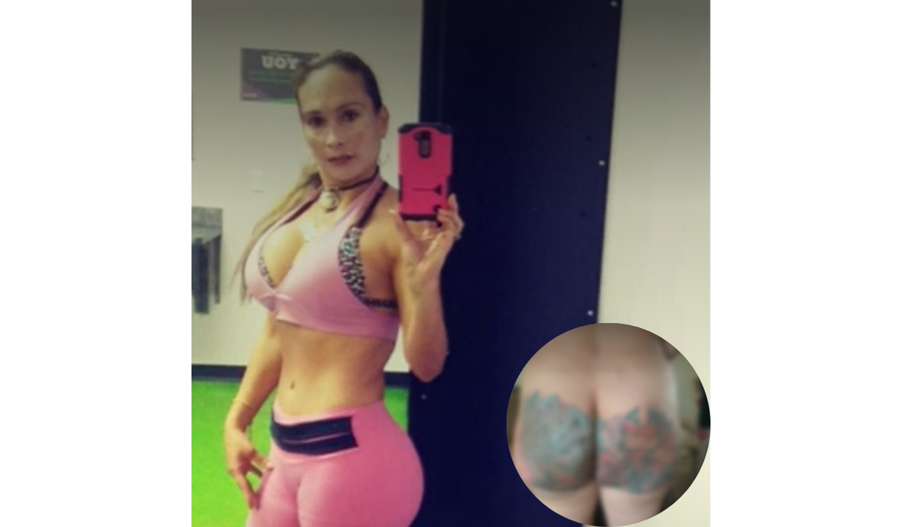 Entrenadora le aplicaron aceite en Medellín