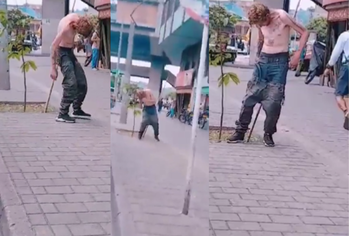 El Zombie de Medellín no era por consumo de fentanilo sino por síndrome de abstinencia