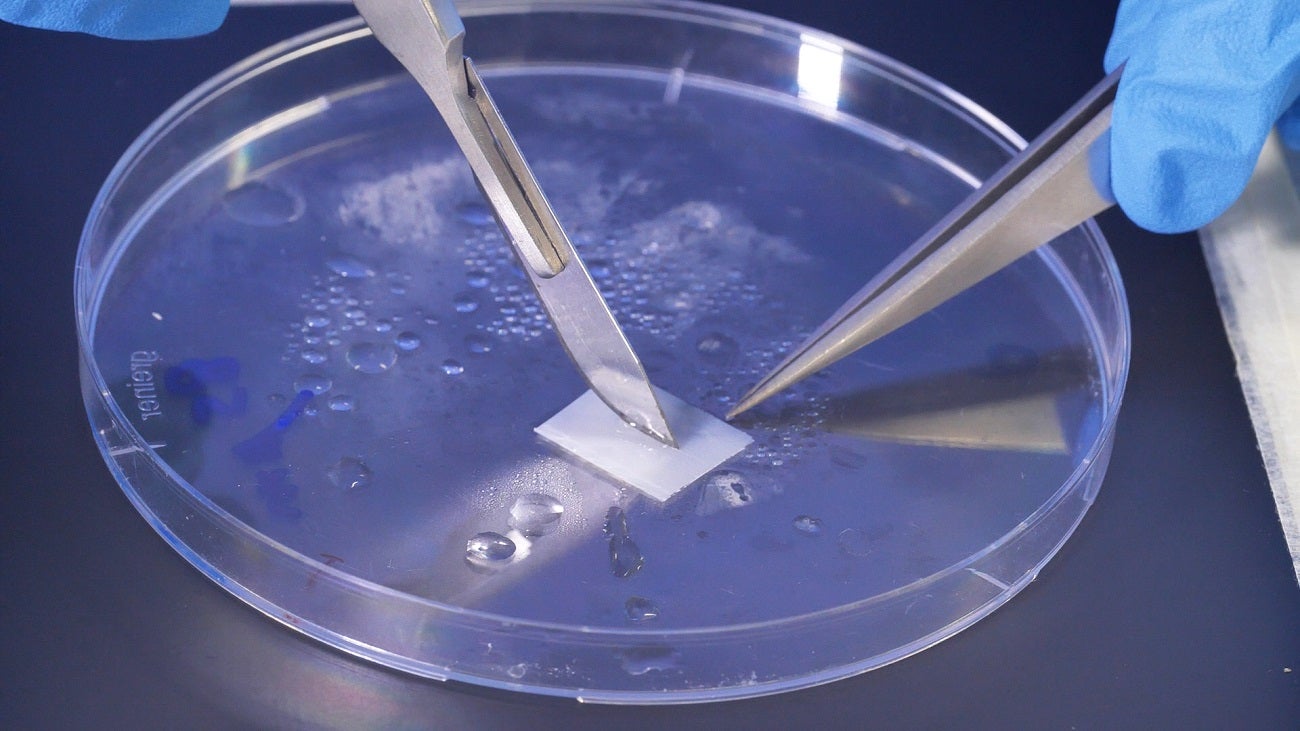 Parche cardiaco con funciones de marcapasos