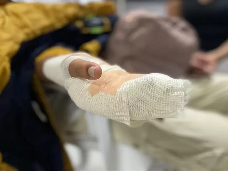 Ya son 36 los lesionados por pólvora en Antioquia