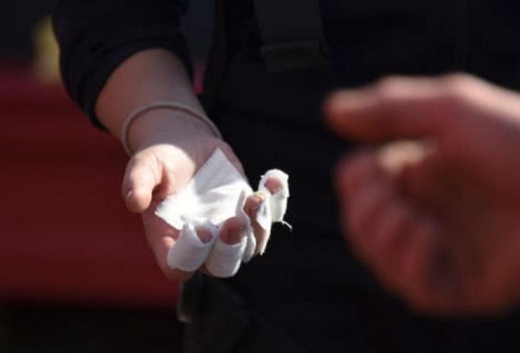 Niños quemados en Navidad