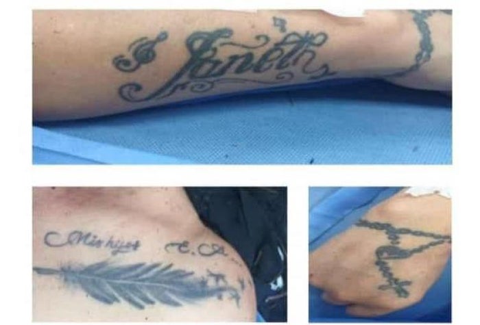 Mujer golpeada en El Retiro