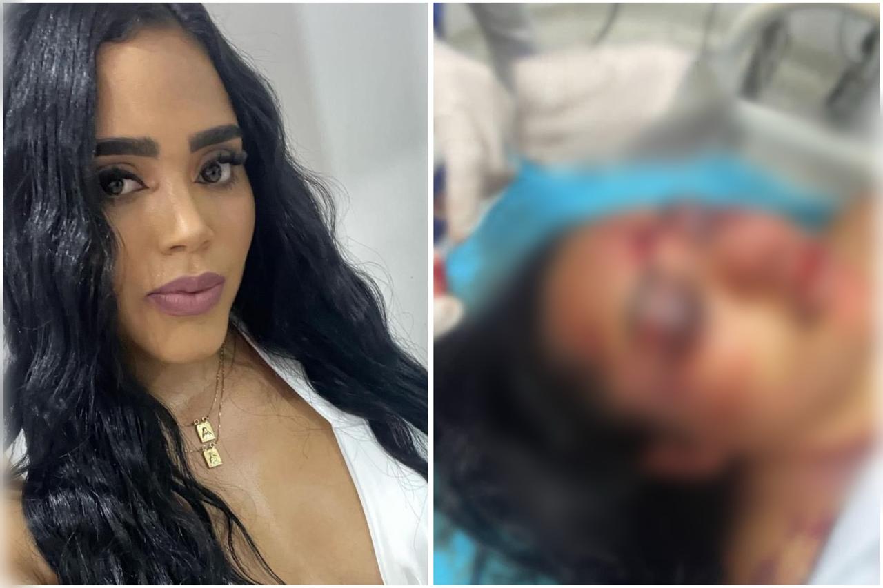 La bella mujer que casi la matan a golpes en el municipio de Turbo, Antioquia