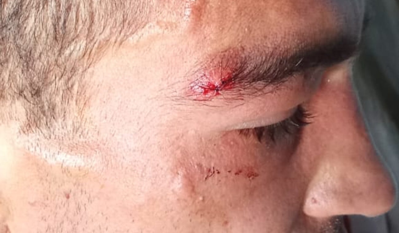 INPEC bajo fuego: Reclusos de Puerto Triunfo denuncian exceso de fuerza y abusos en riña