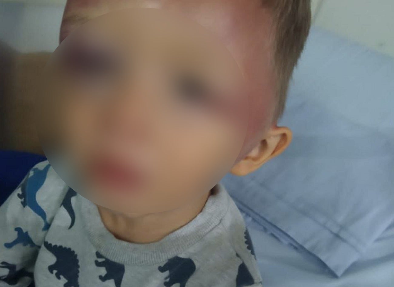 Niño agredido en Itagüí, Antioquia