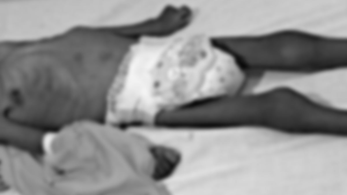 Referencia de desnutrición