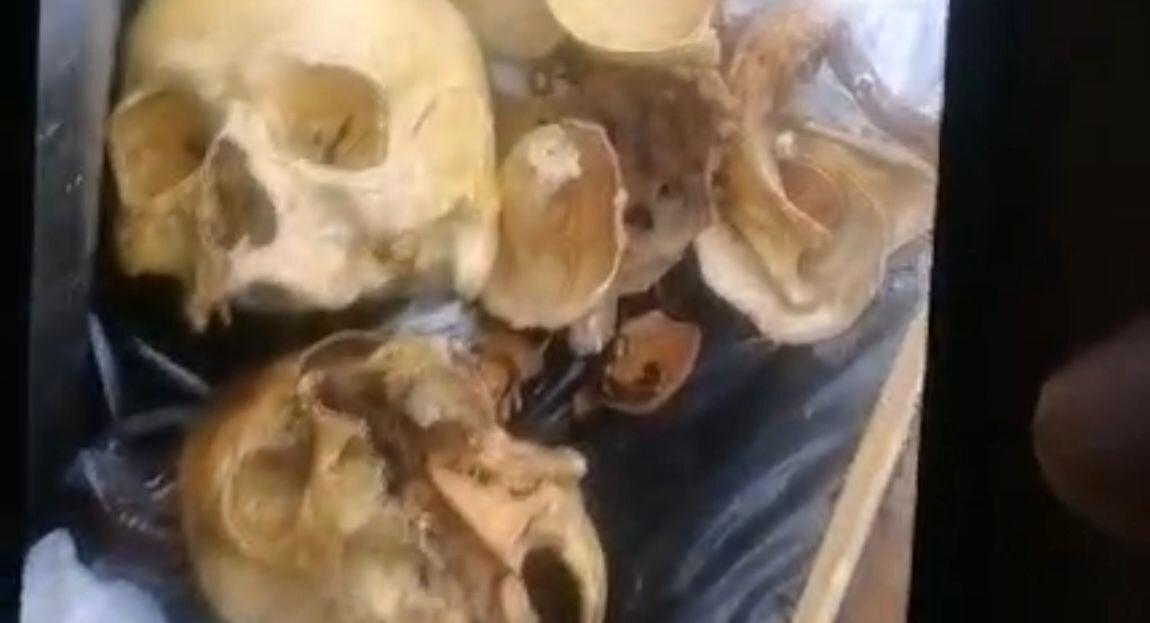 Restos humanos en Medellín