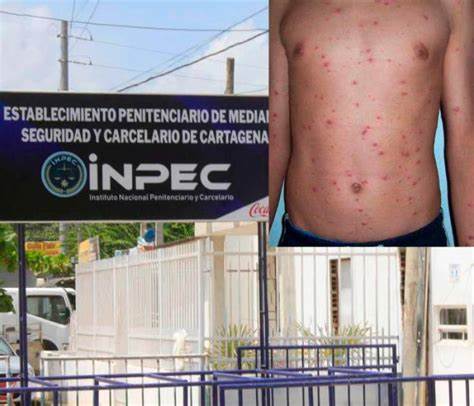 Bomba de tiempo: Denuncian ingreso de reclusos a pabellón infestado con brote de varicela y otras enfermedades en Puerto Triunfo
