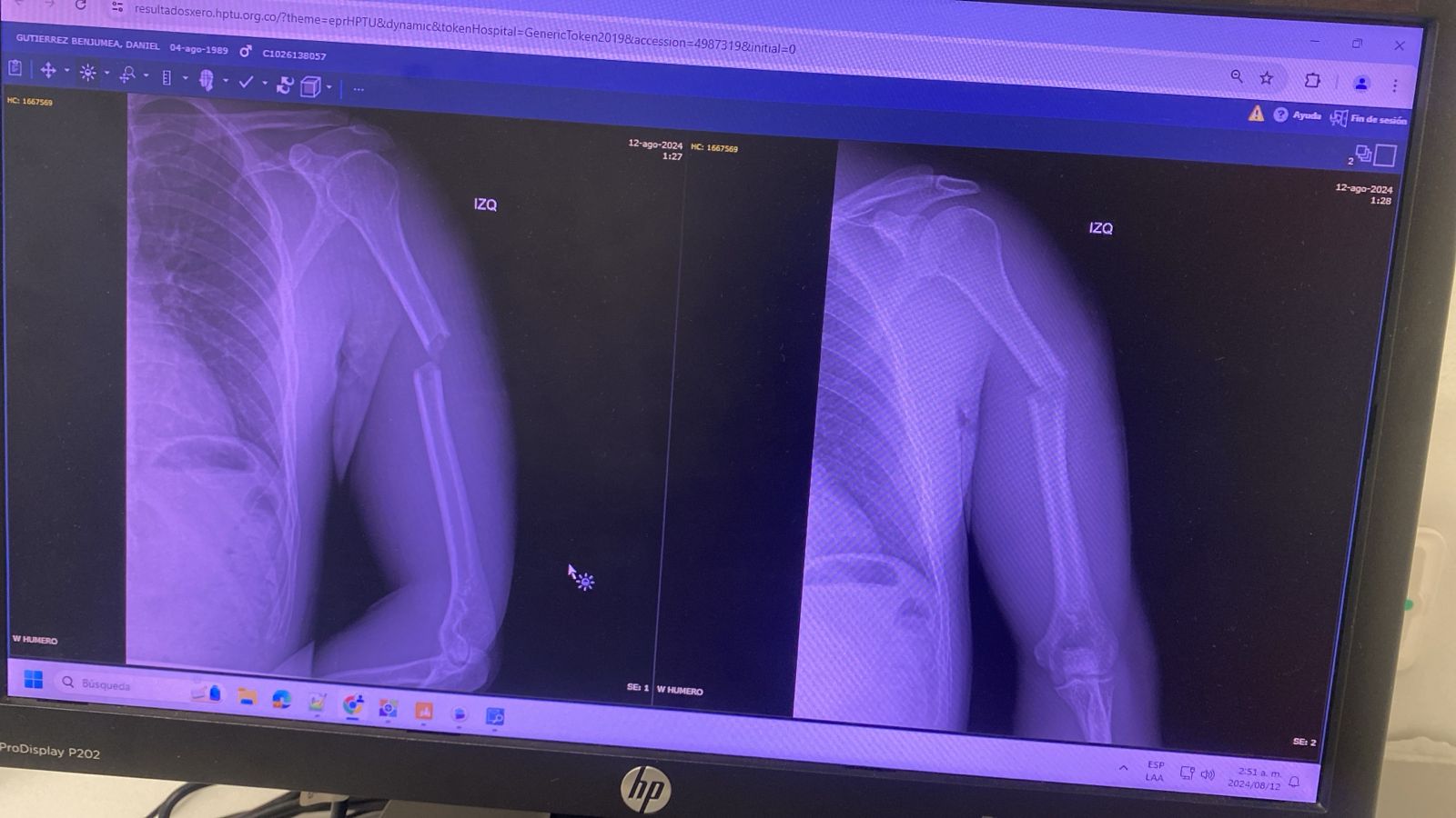 Piedra arrojada a vehículo en vías de la ciudad de Medellín