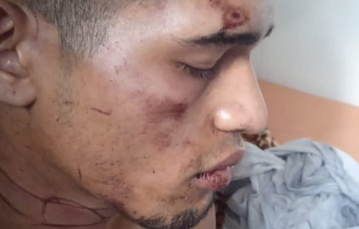 [FOTOS] Guardias del INPEC habrían torturado a un recluso en la cárcel Bellavista: Familiares denuncian brutal agresión