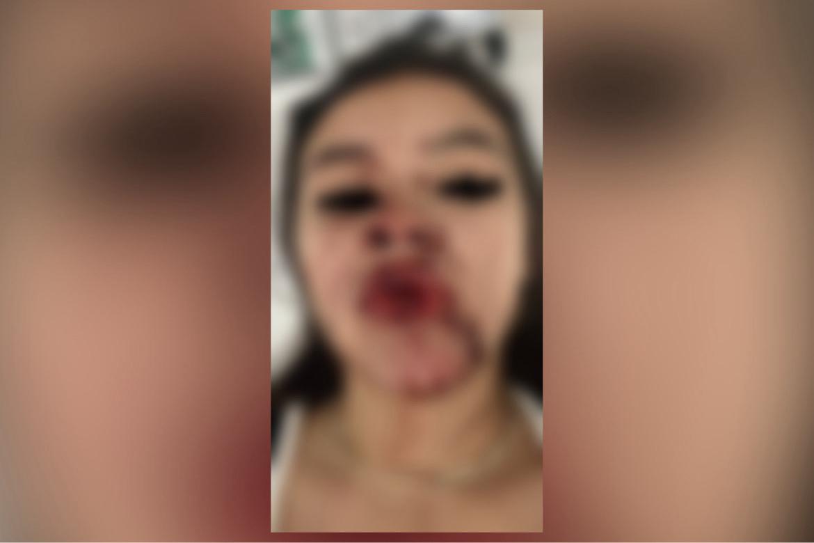 Crónica: Habitante de calle casi mata de una pedrada a Ana Sofia en Medellín