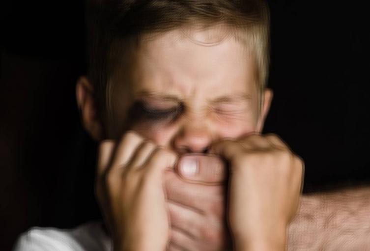 Referencia de niño golpeado