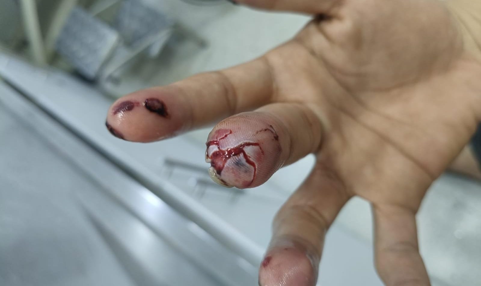 Referencia quemado con pólvora