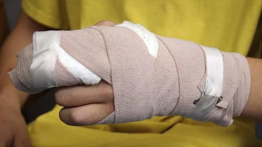 Tres personas quemadas por pólvora en Santa Marta durante la celebración de las velitas