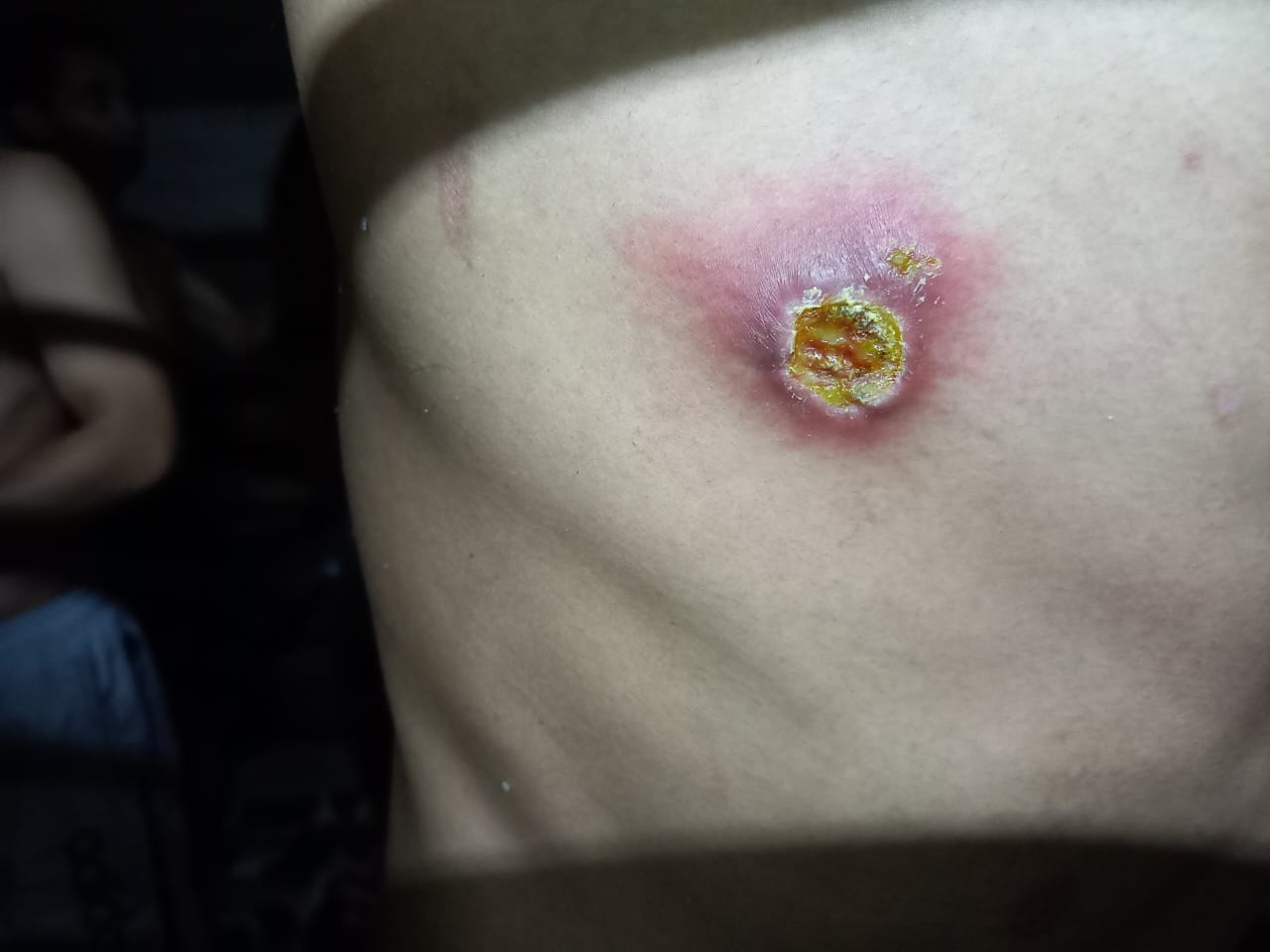 Brotes cárcel de PT Dc 11