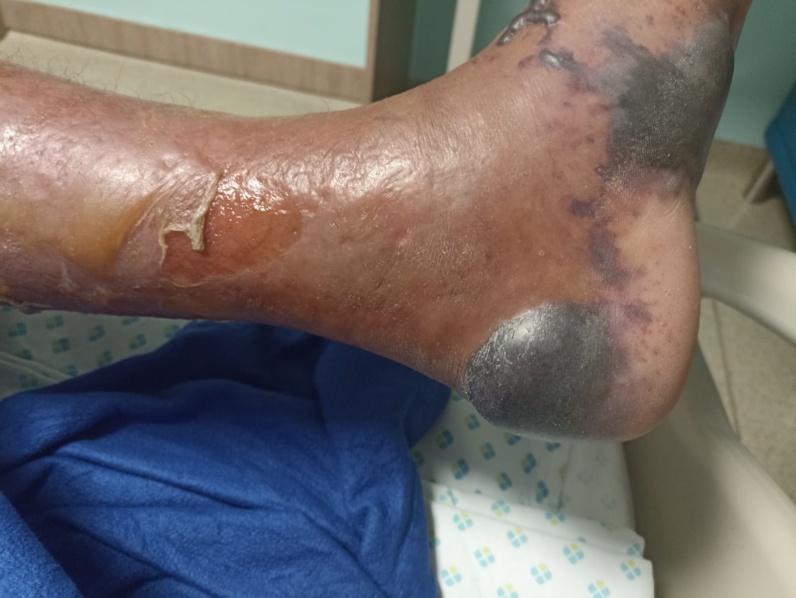 Brotes cárcel de PT Dc 11