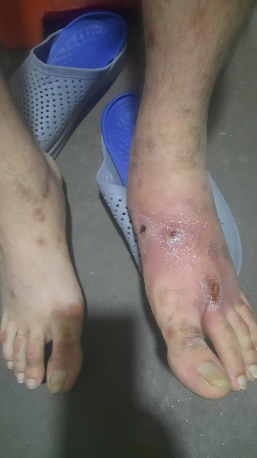 Brotes Cárcel dic11