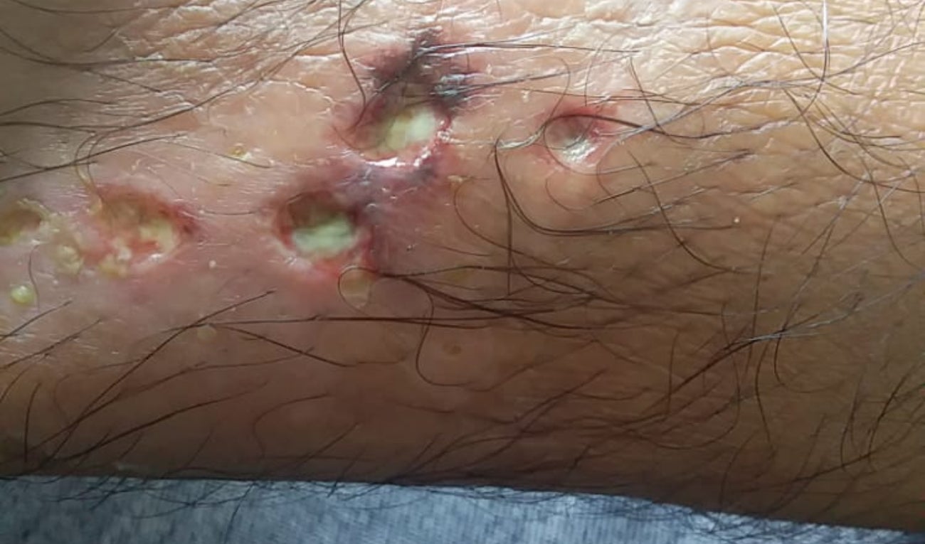 Salubridad cárcel 11 diciembre