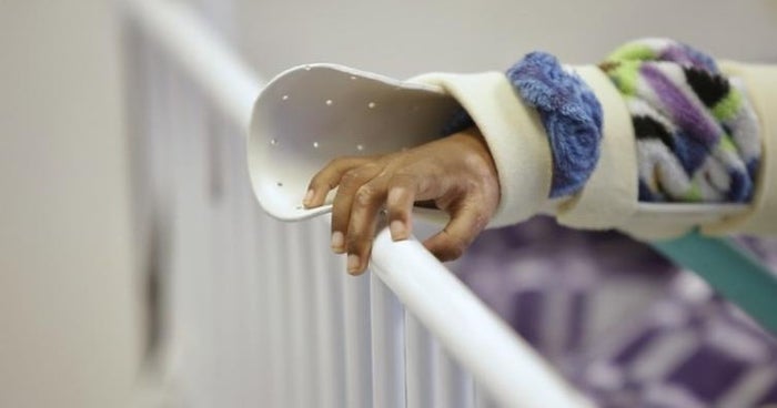 Referencia Menor de edad quemada por pólvora