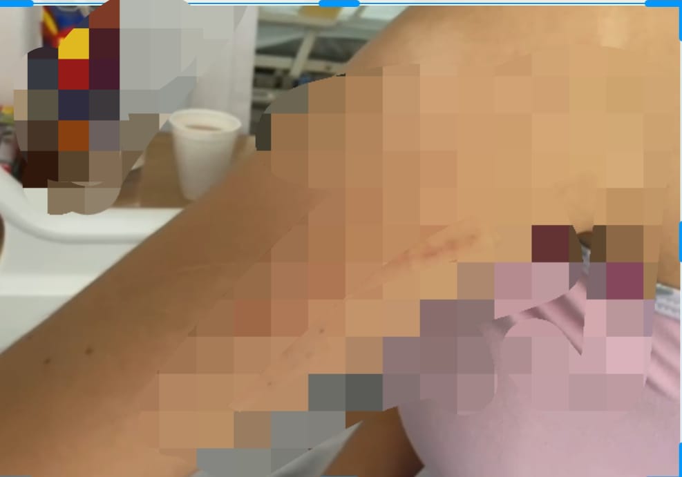 Mujer fue agredida por su madre de familia en Robledo